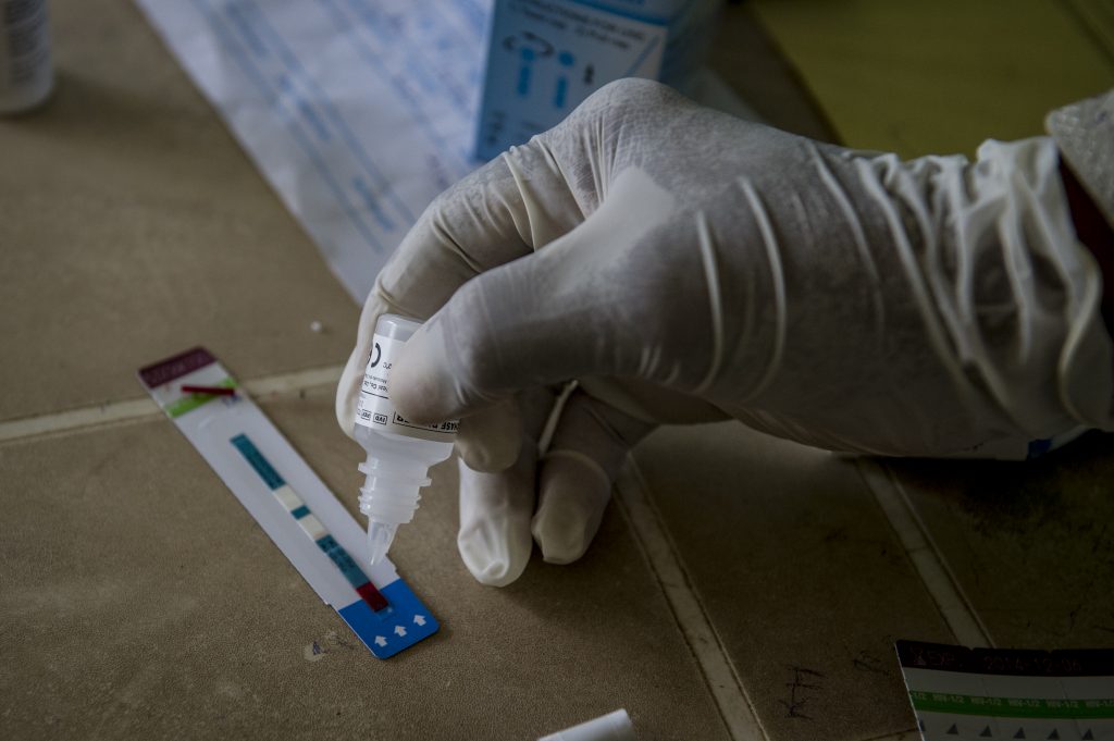 Solution being applied to an HIV testing strip.